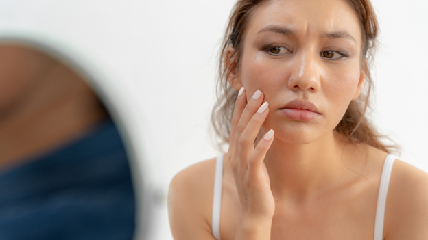 Woman with contact dermatitis looking at her face in the mirror