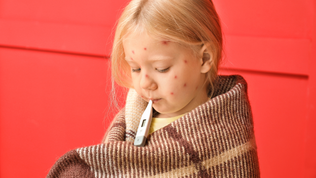 Young girl with chickenpox symptoms wrapped in a blanket