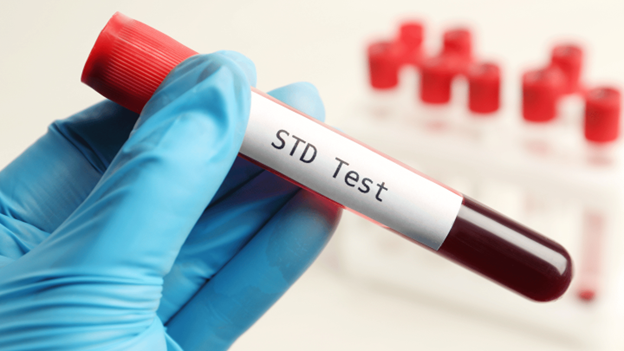 Doctor holding a vial labeled 'STD Test', representing confidential STD testing and diagnosis.