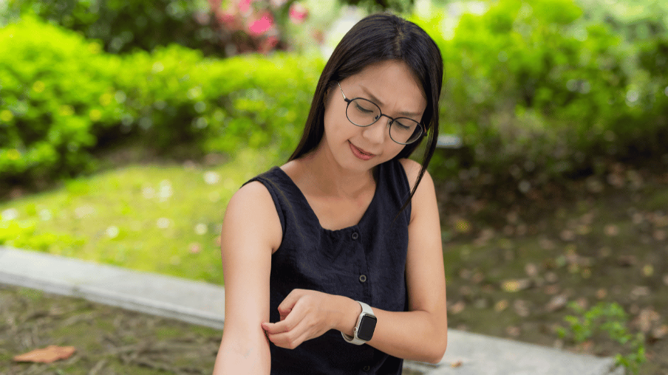 Woman itching an infected bug bite on her arm