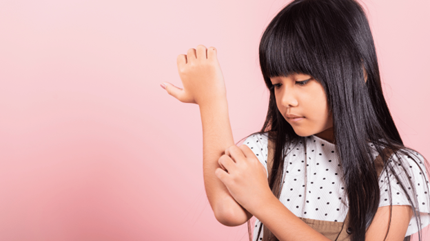 Girl with ringworm itching her arm