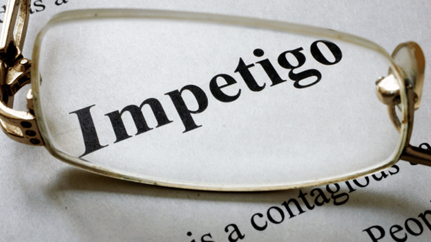 Paper with the word impetigo on it