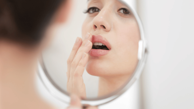 Woman touching a cold sore on her lip